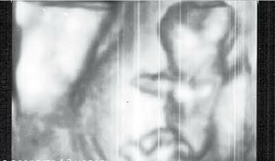 УЗИ в Туле - снимок при сроке 12 недель беременности